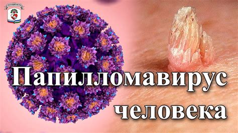 Опасен ли папилломавирус - факты и риски